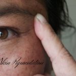 HOW TO DEAL WITH SKIN PIGMENTATION
