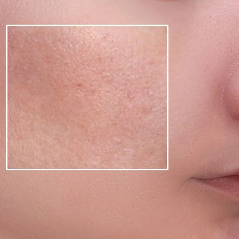 Large Pores