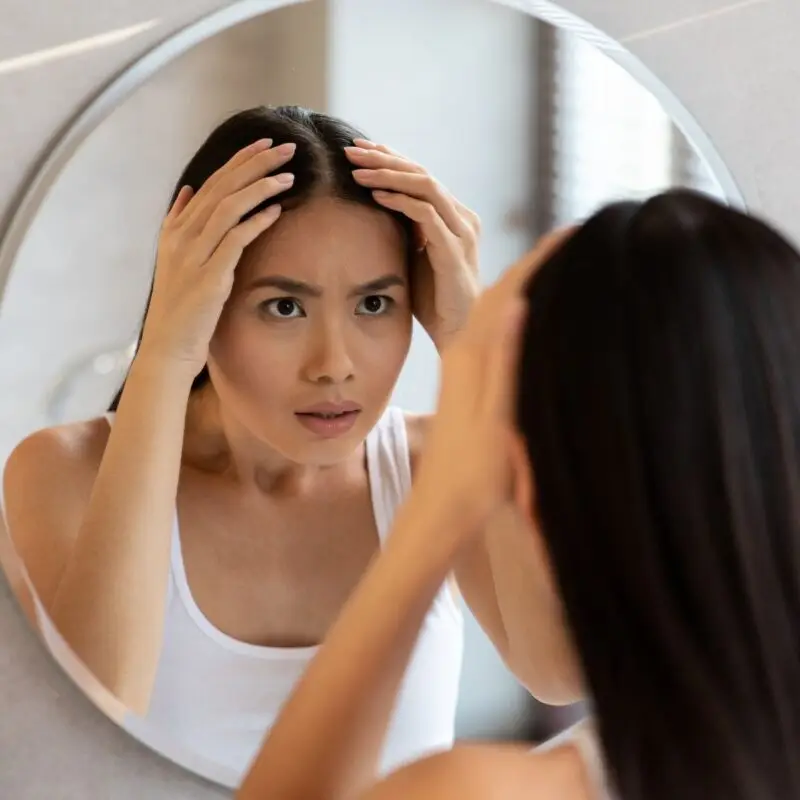 Hair Loss